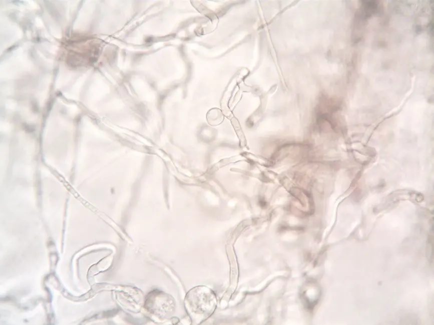 AI disqualification yields new Nikon Small World in Motion winner